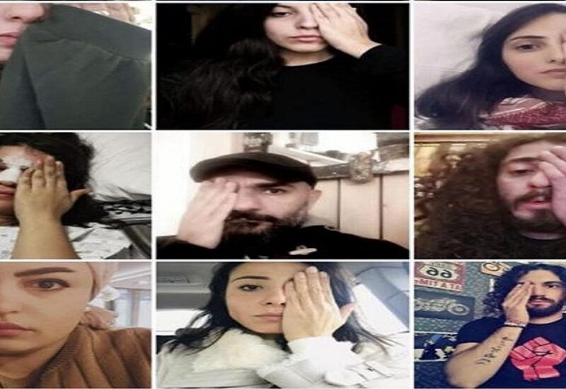 ثورتنا عيونكم حملة اطلقها ثوار ونشطاء لبنان تضامن مع من فقد عينه بإعتداء "قوى الأمن"