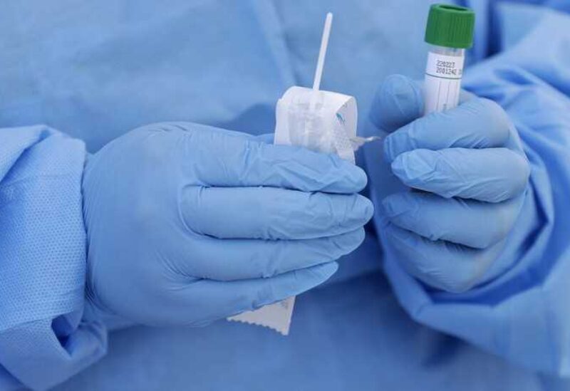 فحص ال PCR