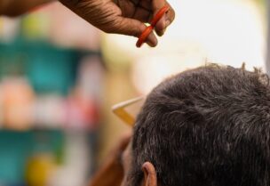 وجد العلماء أن هناك علاقة وثيقة بين قشرة الرأس ومرض باركنسون