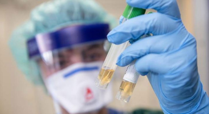 حقن الناس بالفيروس لتسريع اللقاح