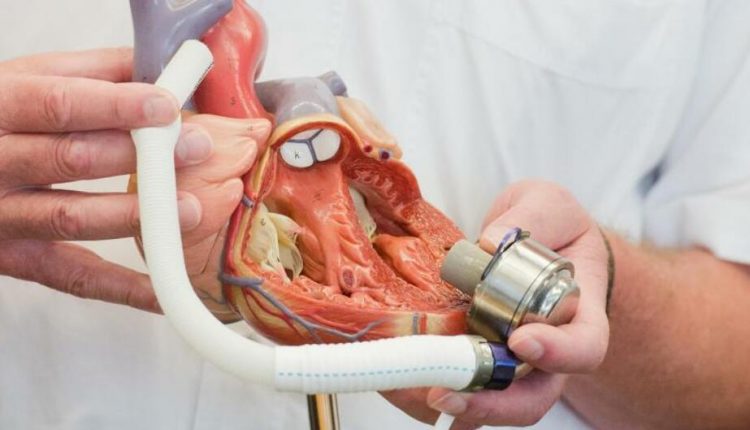 طفرة في علاج مرضى القلب