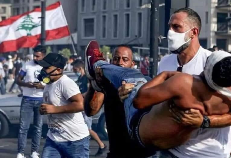 إصابة أحد المتظاهرين نتيحة الاستخدام المفرط للقوة من الأجهزة الأمنية