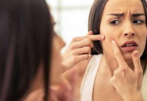 أطعمة تزيد من ظهور حب الشباب