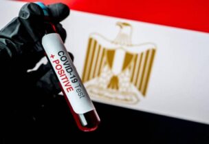 مصر تبدأ التجارب السريرية للقاحين ضد كورونا