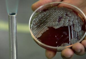 اكتشاف أنواع جديدة من البكتيريا