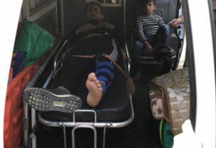 جريحان بانفجار مادة تينر