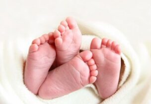 الحمل بتوأم- تعبيرية