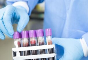 مختبرات تحليل pcr