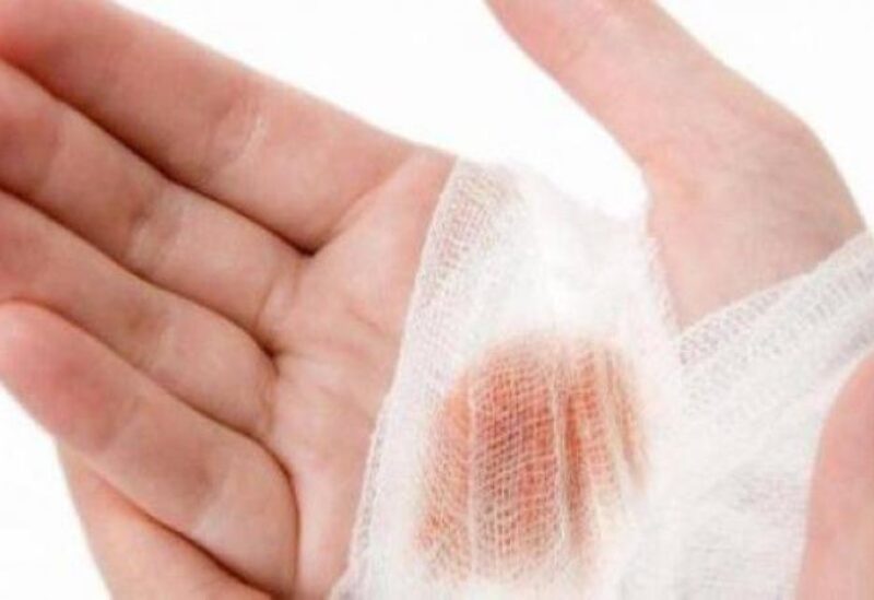 أسباب عديدة تقف وراء عدم التئام الجروح بسرعة