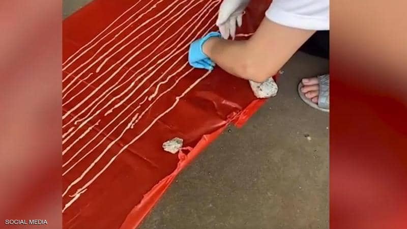 أطباء ينجحون في إنقاذ مريض من دودة عملاقة