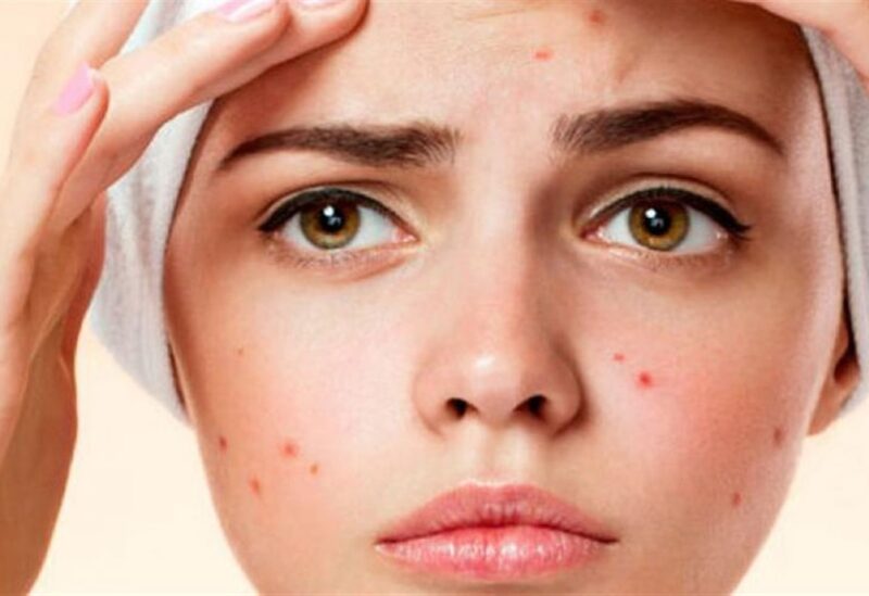 الهرمونات ودورها في تجديد شباب البشرة