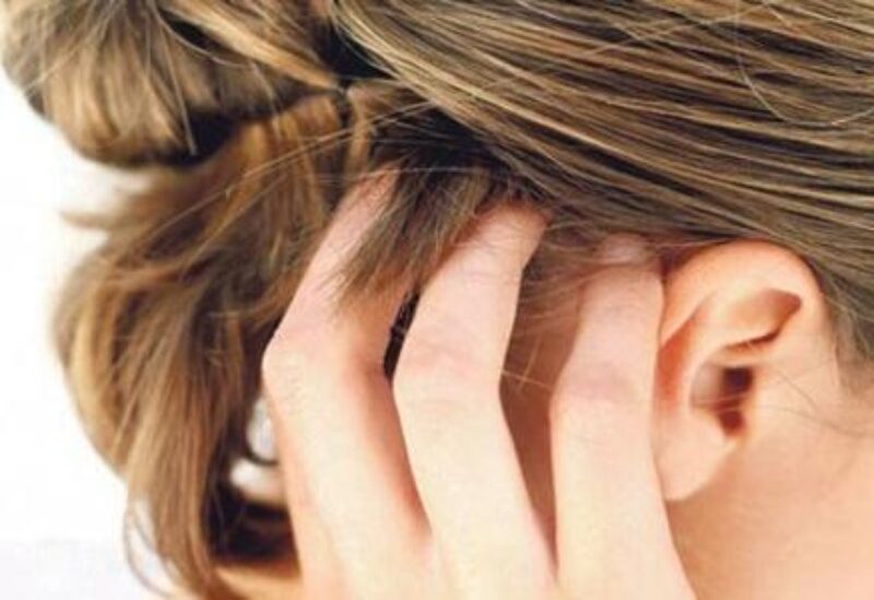 حكة فروة الرأس