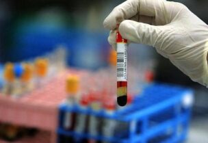 جدل حول مدة بقاء الأجسام المضادة