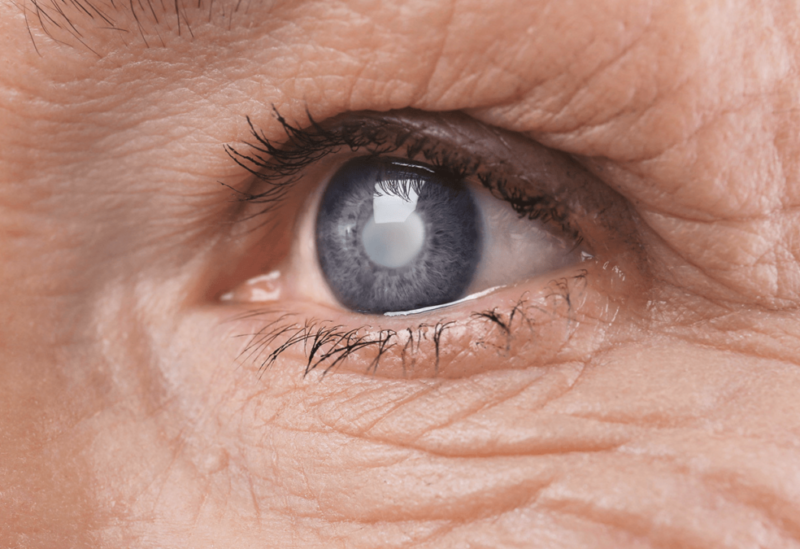 طب وصحة – عدسات لاصقة يابانية ذكية لمراقبة ضغط العين والوقاية من الجلوكوما