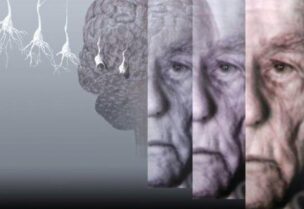 مرض الزهايمر "الخرف"