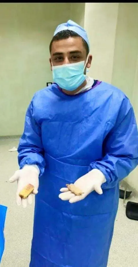 استخراج هاتف من معدة شاب