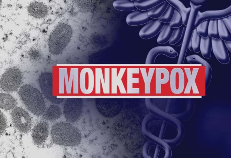 تسجيل إصابات جديدة بفيروس جدري القردة حول العالم