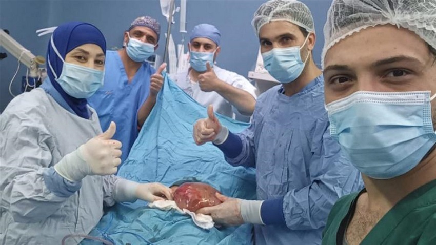 استئصال كتلة غريبة من طفلة سورية تبلغ من العمر 3 سنوات