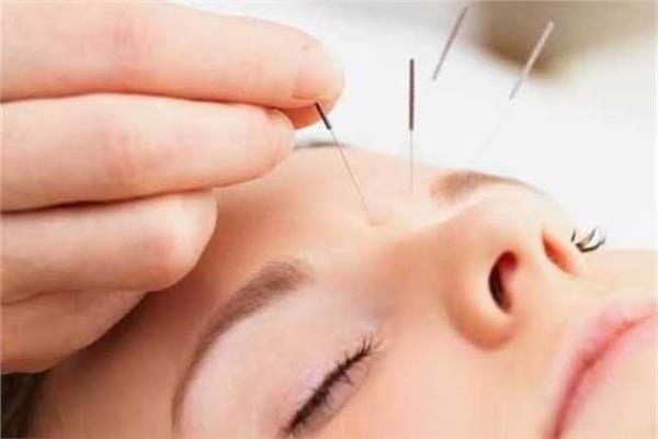 طريقة صينية قديمة للحد من آلام الصداع