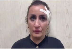 تريد بيع طفلها لإجراء عملية تجميل لأنفها