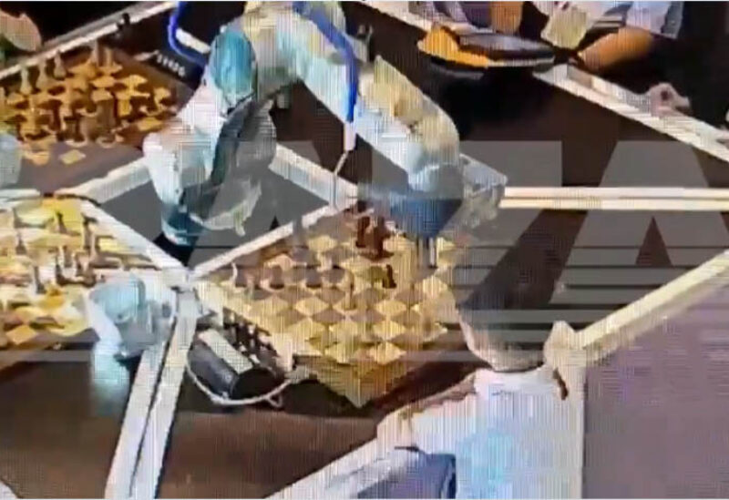 روبوت يخرج عن السيطرة ويكسر إصبع طفل صغير