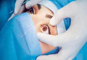 تحذير طبي من عملية تغيير لون العيون التجميلي بواسطة الليزر