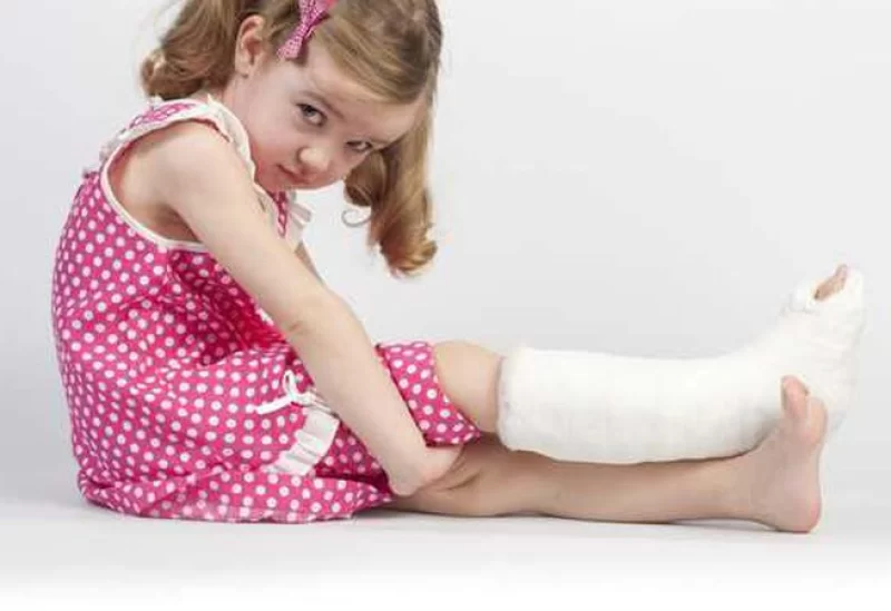 كسر العظم في الطفولة قد يسبب هشاشة العظام
