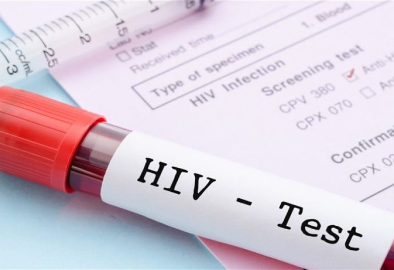 اختبار فيروس نقص المناعة
