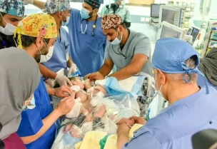 عملية فصل التوأم السيامي