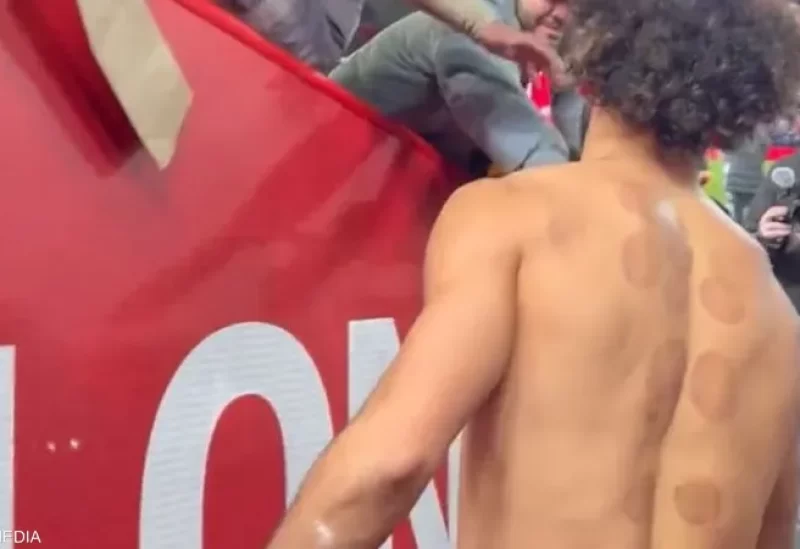 محمد صلاح وآثار الحجامة