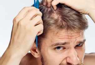 الحكة أحد أسباب الإصابة بفطريات الرأس