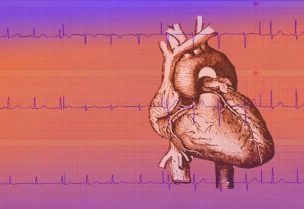 ضربات القلب- تعبيرية
