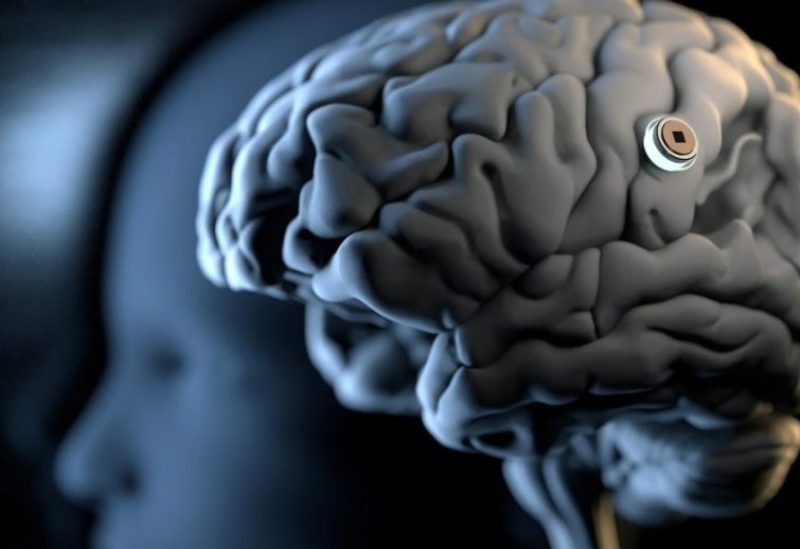 نيورالينك على موافقة من مجلس مراجعة مستقل لبدء أول تجربة بشرية على مرضى الشلل