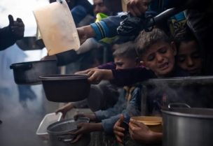 أطفال يعانون من سوء التغذية في غزة