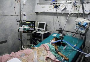 طفلة فلسطينية مصابة بسبب العدوان الإسرائيلي على غزة