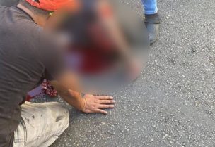 عشرات العناصر من حزب الله أصيبوا بجروح بعضها بليغ في الوجوه