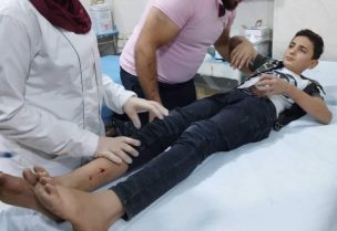 فتى أصيب جراء قصف مدفعي للنظام على الأتارب بريف حلب - 15 تشرين الأول 2024 (الدفاع المدني السوري)