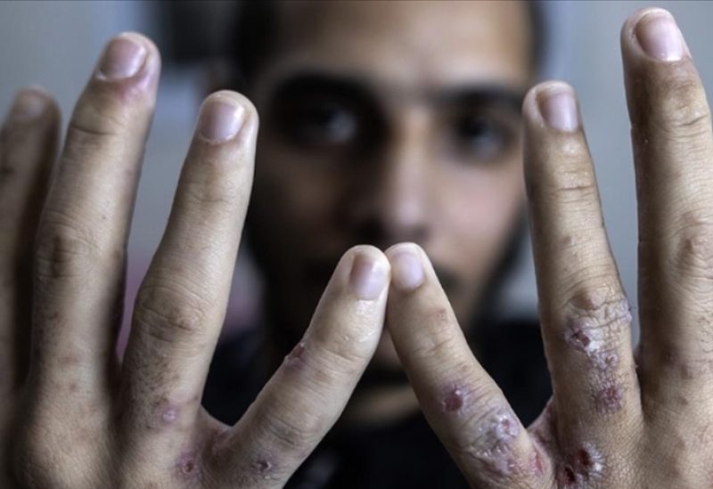 أحد الأسرى الفلسطينين في سجون إسرائيل