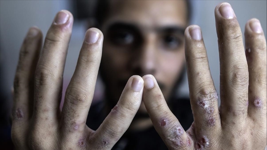 أحد الأسرى الفلسطينين في سجون إسرائيل