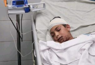 الطفل آدم النجار بعد إصابته بجروح خطيرة بقصف إسرائيلي على غزة