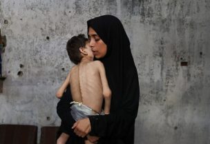 أم فلسطينية نازحة تحمل ابنها الذي يعاني من سوء التغذية والشلل الدماغي، في مدرسة حيث يلتجئون وسط أزمة جوع، في مدينة غزة، 24 يوليو 2025. رويترز