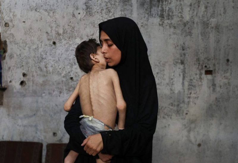 أم فلسطينية نازحة تحمل ابنها الذي يعاني من سوء التغذية والشلل الدماغي، في مدرسة حيث يلتجئون وسط أزمة جوع، في مدينة غزة، 24 يوليو 2025. رويترز