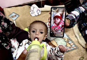 أطفال لا يقدرون حتى على البكاء في مستشفى بغزة