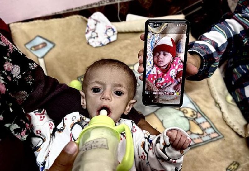 أطفال لا يقدرون حتى على البكاء في مستشفى بغزة