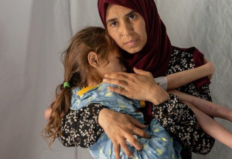 أرواح غزة تتساقط تحت مقصلة التجويع