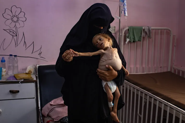 الطفلة شام بين ذراعي والدتها في مجمع ناصر الطبي بخان يونس في صورة بتاريخ 10 أغسطس/آب الجاري (الأوروبية)