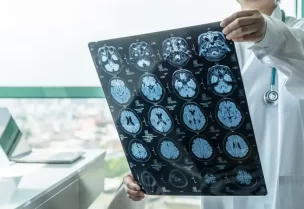 قطرات أنفية جديدة قد تفتح باب أمل لعلاج الأورام الأرومية الدبقية في الدماغ