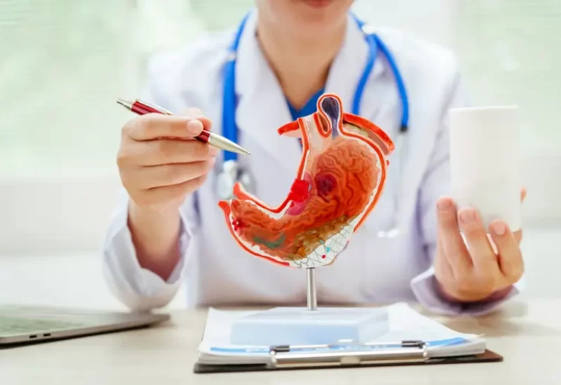 طب وصحة – رمضان وقرحة المعدة وارتجاع المريء.. كيف تصوم بأمان وتتجنب نوبات الألم؟