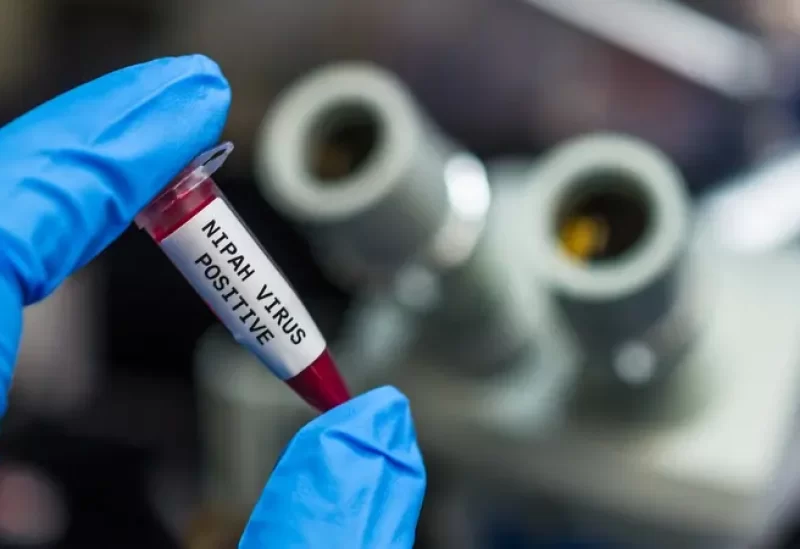 جامعة طوكيو تبدأ أول تجارب بشرية على لقاح ضد فيروس نيباه القاتل