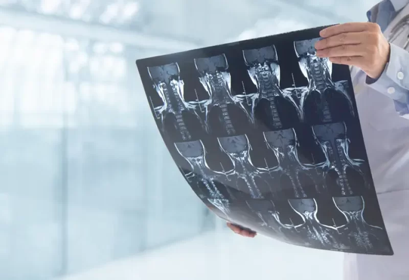 طب وصحة – يعمل الذكاء الاصطناعي على تبسيط تقارير الأشعة ويجعلها أقرب إلى فهم المرضى